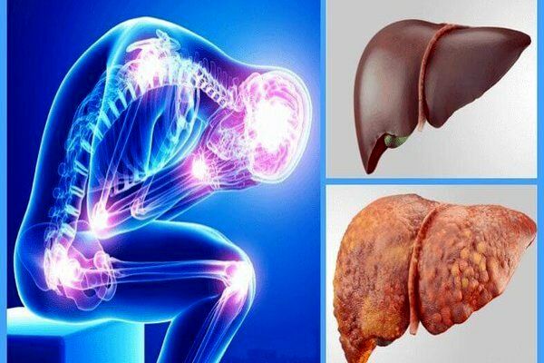 سیاهدانه با کبدچرب چه می کند